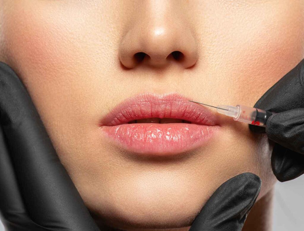 Filler Injection Rose Beauty Clinic in North York